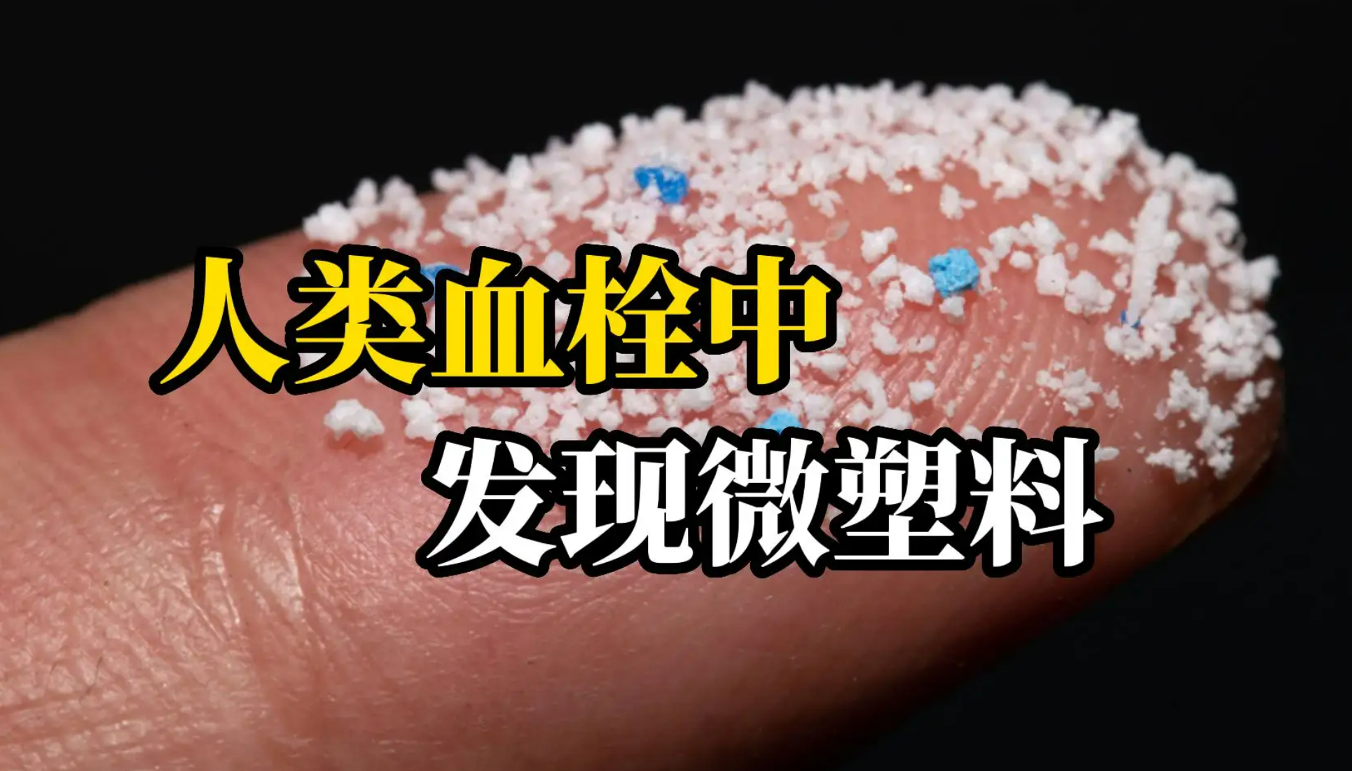 震驚！人類血栓中首次發(fā)現(xiàn)微塑料！